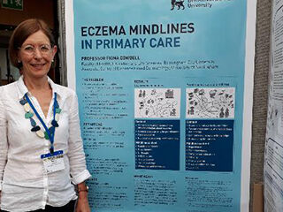 Eczema mindlines Fiona image